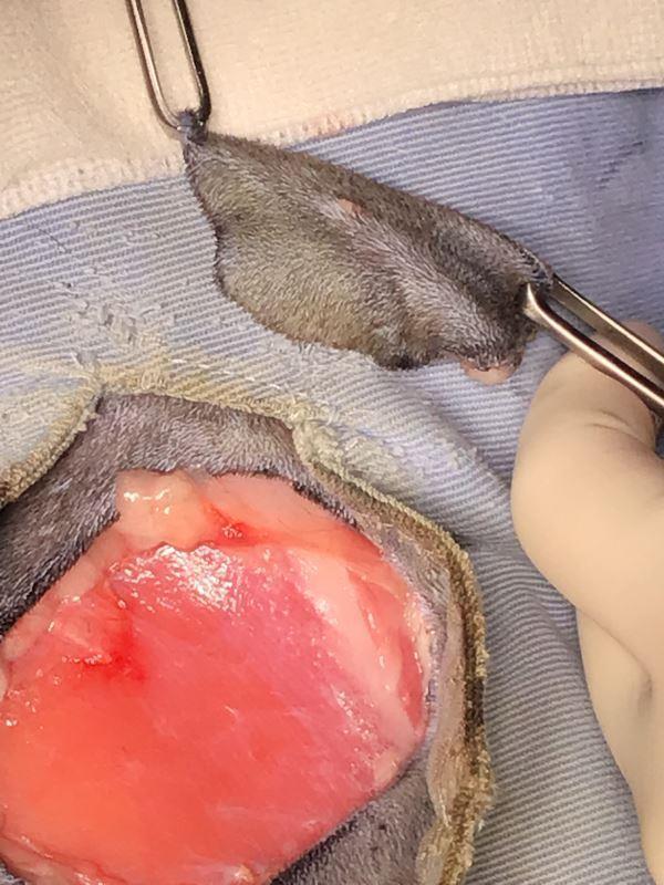 腫瘍を摘出した直後の手術中の写真